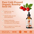 Organic Cold-pressed Rosehip Seed Oil 100  Pure Raw Skin Hair Face Anti-aging