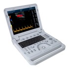 Portable Color Doppler Ultrasound Scanner Machine Diagnosticsystem Convex Linear