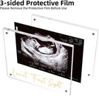 Ultrasound Picture Frame  Sonogram Love At First Sight Baby Clear   Gold 