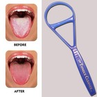 Tongue Scraper Cleaner - The Tongue Cleaner - End Bad Breath And Freshens Bre   