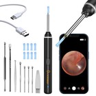 Hd Ear Scope With Camera - 1920p Wifi Otoscope Kit With Led Lights   Spoons