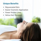Bodymed Dermaplaning Blades  10r In Carbon Steel  100 Pcs - Sterile