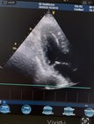 Ge Vivid I Bt12 Ultrasound With Refurbished 3sc-rs Cardiac Probe  All Options On