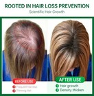 7 Days Ginger Hair Regrowth Serum   Stop Hair Loss