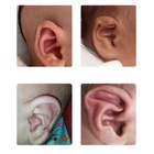 Ear Orthopaedic Patch Protruding Ear Corrector Baby Ear Support Patches