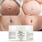 Stretch Mark   Scar Removal Cream - Pregnancy Skin Repair  Firming   Eradication