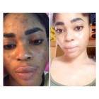 Dark Skin Whitening Oil   Dark Spot  brightening Bleaching Lightening Serum Oil