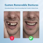 Custom Removable Dentures     Personalized Partial Denture Set For Tooth Rep