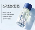 Dr leo Salicylic Acid Acne Serum 10ml     Anti Acne  Scar   Pimple Treatment