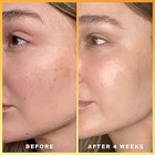 Kojic Acid Skin Whitening Lightening Brightening Serum Bleaching spot Fade Cream