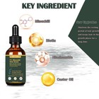 180ml 5  Minoxidil Hair Growth Oil  Hair Serum For Healthier And Thicker Hair