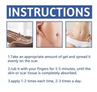 Scar And Acne Mark Removal Gel Ointment Remove Scars Burns Stretch Marks