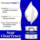 Scar Removal Cream - Old Scars Stretch Mark Spots  Surgery  Burn  Injury Scar