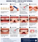 Missing Tooth Kit Replace Missing Front Teeth 1-6 At Home Partial Flipper Teeth