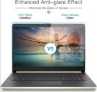 Anti Glare Screen   Keyboard Protector For Asus Zenbook Pro Duo Ux581 Ux582