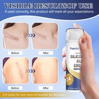 Advanced Silicone Scar Gel    scar Reduction  1 7 Oz - 2 Day Free Delivery