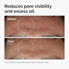 The Ordinary Niacinamide 10    Zinc 1   Smoothing Serum For Blemish-prone Skin