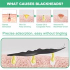 Purifying Acne Peel-off Mask    facial Cleansing Blackhead Remover Charcoal Mask