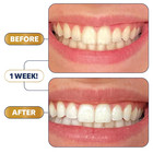 Teeth Whitening Strips Kit - 9 Treatments - Peroxide Free - Enamel Safe For Whit