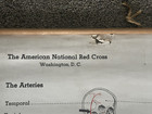 1933  American Red Cross First Aid Instruction Chart Poster 35 By 22 Inches