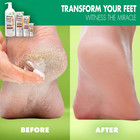 Miracle Foot Repair Cream   1 Oz   3 Pack  Repairs Dry Cracked Heels And Feet