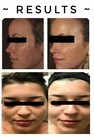 Dark Skin Permanent Bleaching Cream Whitening Brightening Lightening 20gm