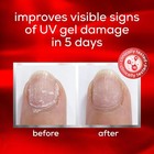 Essie To The Rescue Uv Gel Damage Repair For Nails Damage Treatment 0 46 Fl Oz