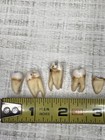 Lot Of 5 Real Human Adult Teeth Anatomy Tooth Medical Specimen Dental Oddity