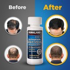 Kirkland Minoxidil 5  Hair Regrowth  xtra Strength  6 Month Supply-exp-mar-2027