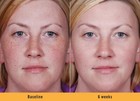 Kojic Acid Skin Whitening Lightening Ultra Brightening Serum Dark Spot Cream