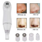 Diamond Dermabrasion Microdermabrasion Vacuum Peeling Skin Facial Beauty Machine
