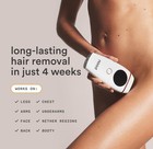 Nood Flasher  2 0 Ipl Laser Hair Removal Handset     White  Permanent   Painless 