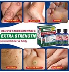 Biwakush Liquid Wart  Corn   Callus Remover 40  Salicylic Acid 2 Pack 30ml