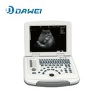 Digital Portable Ultrasound Machine Human B Ultrasonic Scanner Ce Iso 5 Probes