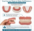 Self-fit Boil   Bite Dent  For Narrow Or Wide Arches - Confidence At Home