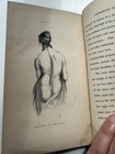 1839 Coulson Deformities Chest Spine 2nd Ed Antique Medical Book Plates