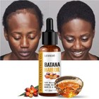 Naturals Batana Oil Fast Hair Growth For Men Women Pure Batana Oil Nourish Shiny