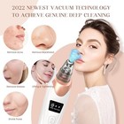 Blackhead Remover Pore Vacuum facial Pore Cleaner-5 Suction Power 5 Probes  Usb 