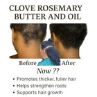 Clove Rosemary Growth Oil   Butter Set   Fast Growth Thinning Edges  4b 4c Hair