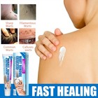 Professional Wart And Skin Tag Remover Cream Topical Skin Repair Treatments