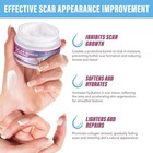 Scar Cream Removal Rapid Repair Of New Old Scars burns All    