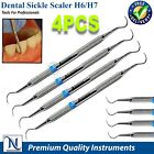 Sickle Scaler Anterior Posterior Hygiene Sickle Scalers Dental Steel Instruments