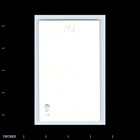 Old Vintage Photo Man Hat Hands In Pockets 1930s