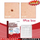Microneedle Botanic Skin Tag   Acne Patch Skin Tag Remover Patches 9pcs