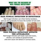Nail Fungus Light Therapy Device Onychomycosis Treatment For Multiple Toenails