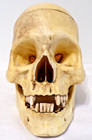 Life Size Realistic Rotting Skull With Moveable Jaw - Nib - See Below