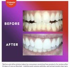 1 New Colgate Optic White Comfortfit Led Teeth Whitening Kit