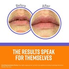 Lip Repair Night Treatment Lip Balm  0 25 Ounce Jar   pack