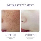Strong Removal Melasma Whitening Cream Freckle Speckle Sunburn Spots Pigment 30g