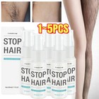 100  Natural Permanent Hair Removal Spray Stop Hair Growth Inhibitor Remover 20g